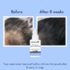 WishCare Hair Growth Serum before after results on female hair