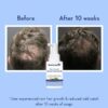 WishCare Hair Growth Serum before after results on male hair