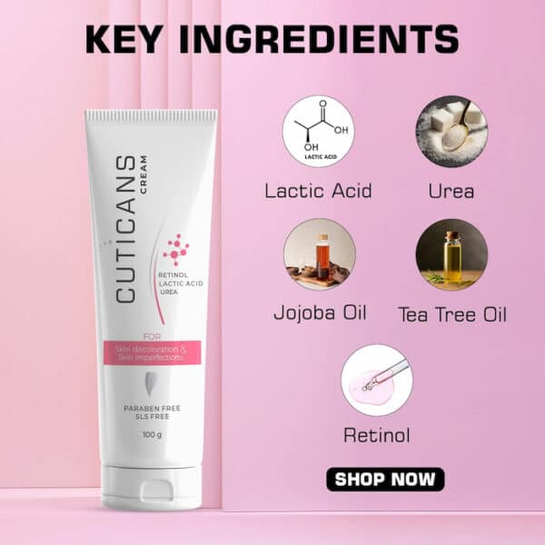 Cuticans Cream shown with key ingredients such as lactic acid, urea, jojoba oil, tea tree oil, and retinol for treating skin imperfections.
