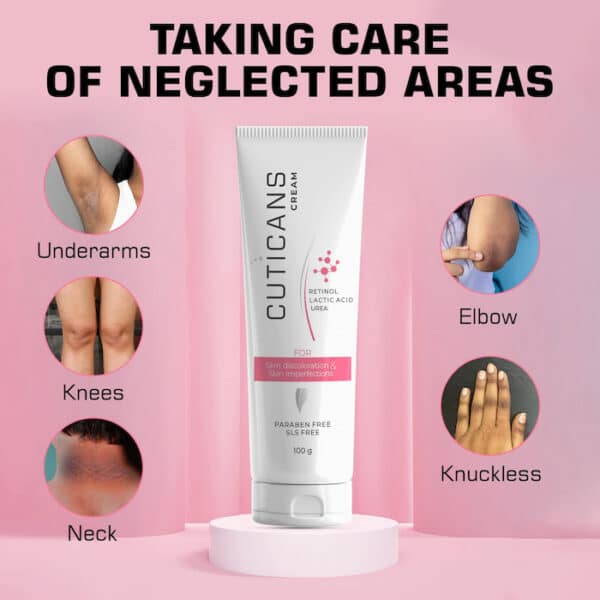 Cuticans Cream displayed with targeted areas including underarms, knees, neck, elbows, and knuckles for skin discoloration and imperfections.