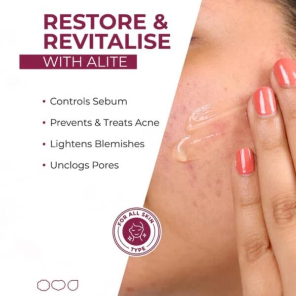 Alite Anti Acne Gel being applied on acne-prone skin to control sebum and reduce blemishes